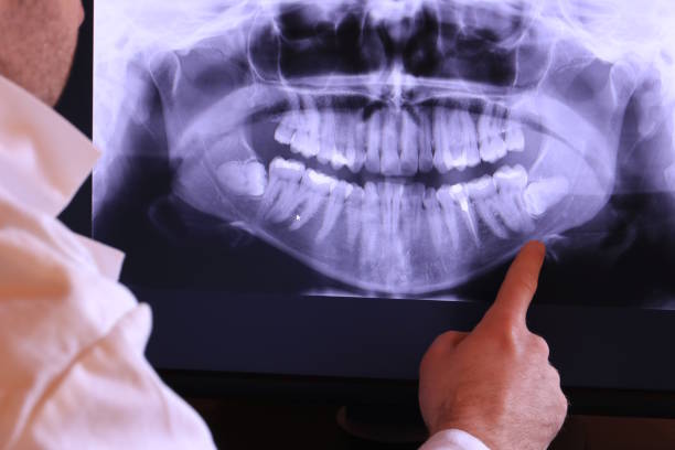 Best Emergency Denture Repair in Legend Lake, WI