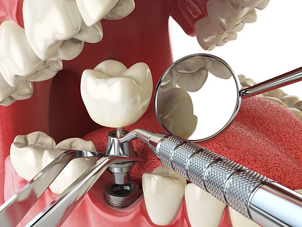 Best Cosmetic Emergency Dentistry in Legend Lake, WI